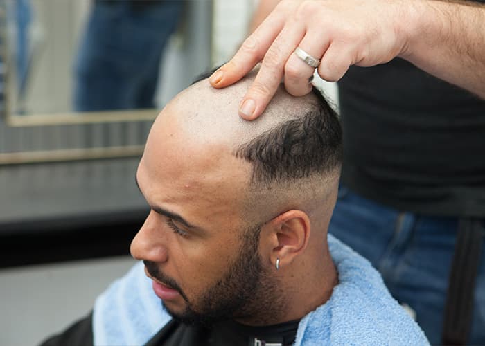 Preparation & Measurement